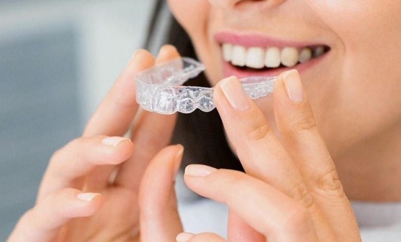 Difference Between Invisalign and Dental Braces Application