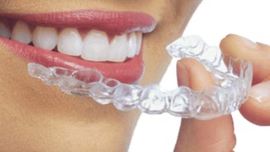 INVISALIGN