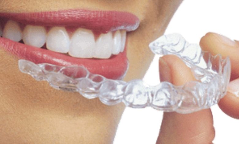 INVISALIGN