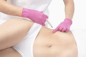 liposuction