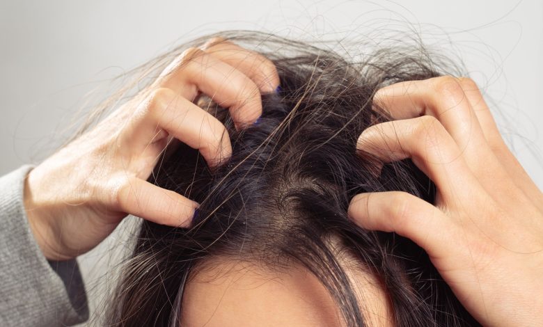 get rid of dead skin cells from scalp