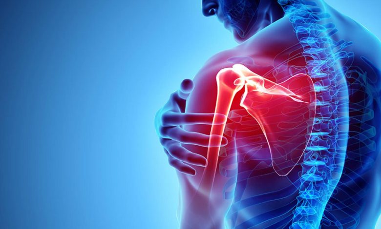 shoulder pain