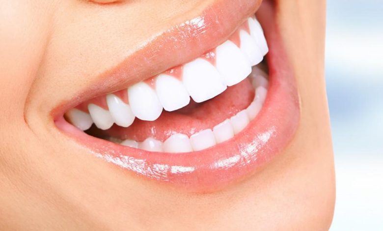 zoom teeth whitening