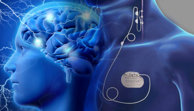 neuromodulation Market Size