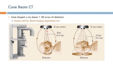 Cone Beam Volumetric Tomography (CBVT)