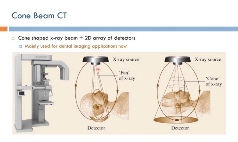 Cone Beam Volumetric Tomography (CBVT)