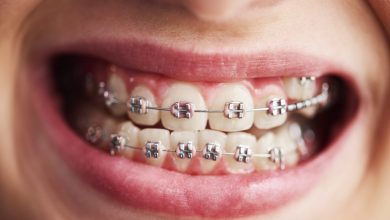 braces near me