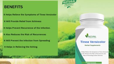 Natural Remedy for Tinea Versicolor