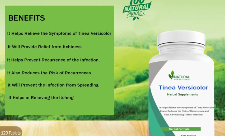 Natural Remedy for Tinea Versicolor