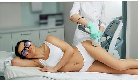 Laser hair removal Orlando