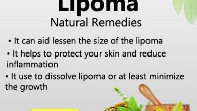 Lipoma Removal Without Surgery