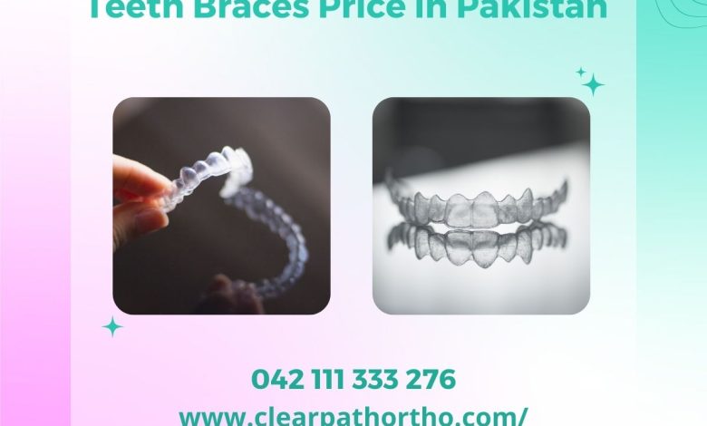 Teeth Braces Price in Pakistan