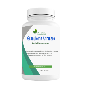 5 Less Common Granuloma Annulare Natural Treatments